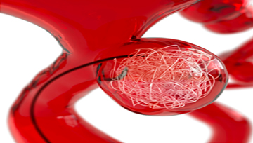 3D 혈관 시뮬레이터 및 투시 조영술 X-ray 사진3